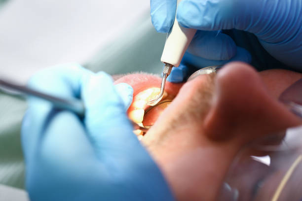 Best After-Hours Dental Trauma Care in St Pauls, NC