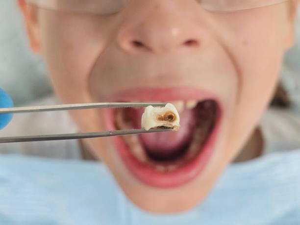  St Pauls, NC Emergency Dentist Pros