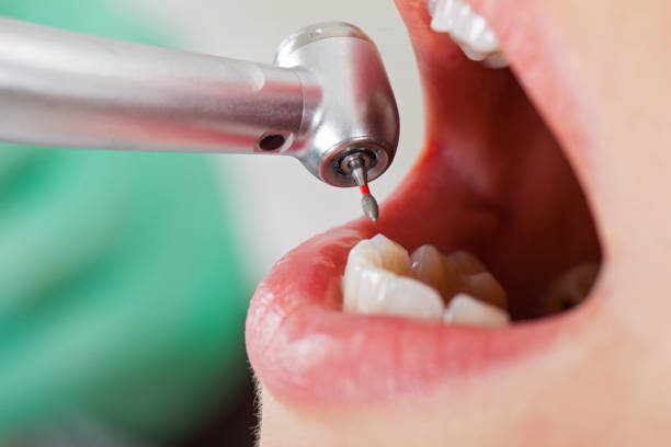 Best Emergency Treatment for Dental Infections or Abscesses in St Pauls, NC